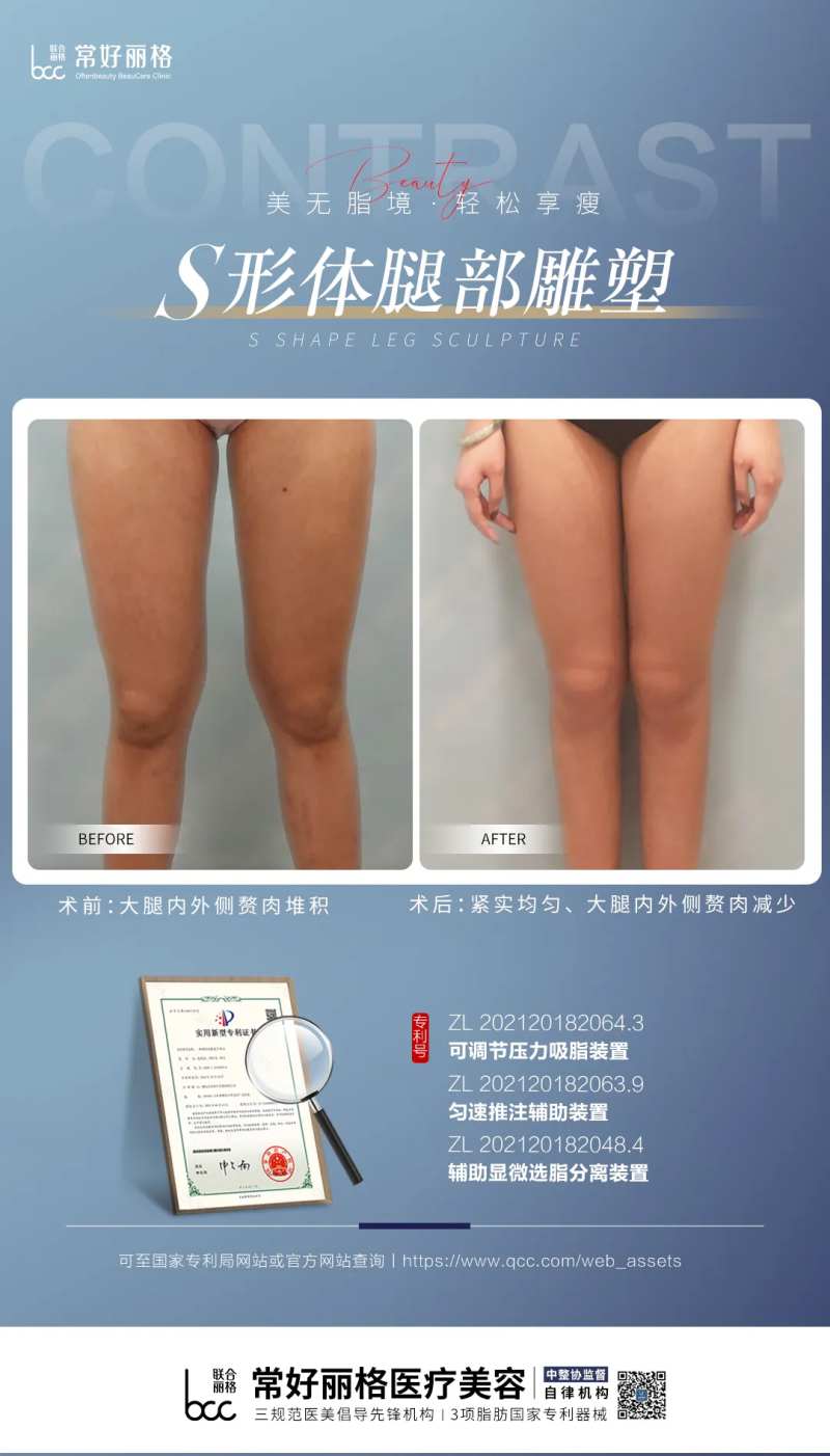 医美吸脂案例对比海报-采灵感-cailinggan.com