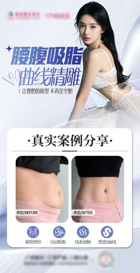 医美腰腹吸脂案例-采灵感-https://www.cailinggan.com/