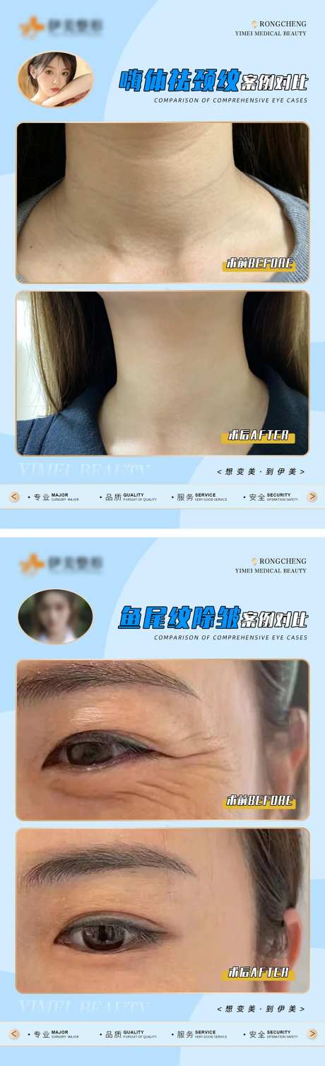 医美案例对比模版海报-采灵感-https://www.cailinggan.com/