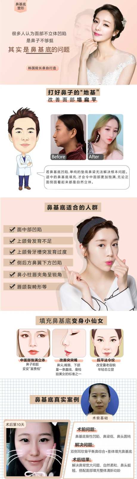 鼻基底详情页-采灵感-https://www.cailinggan.com/