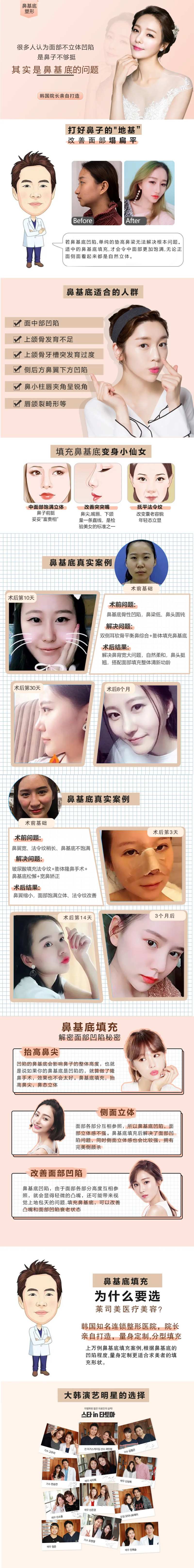 鼻基底详情页-采灵感-cailinggan.com