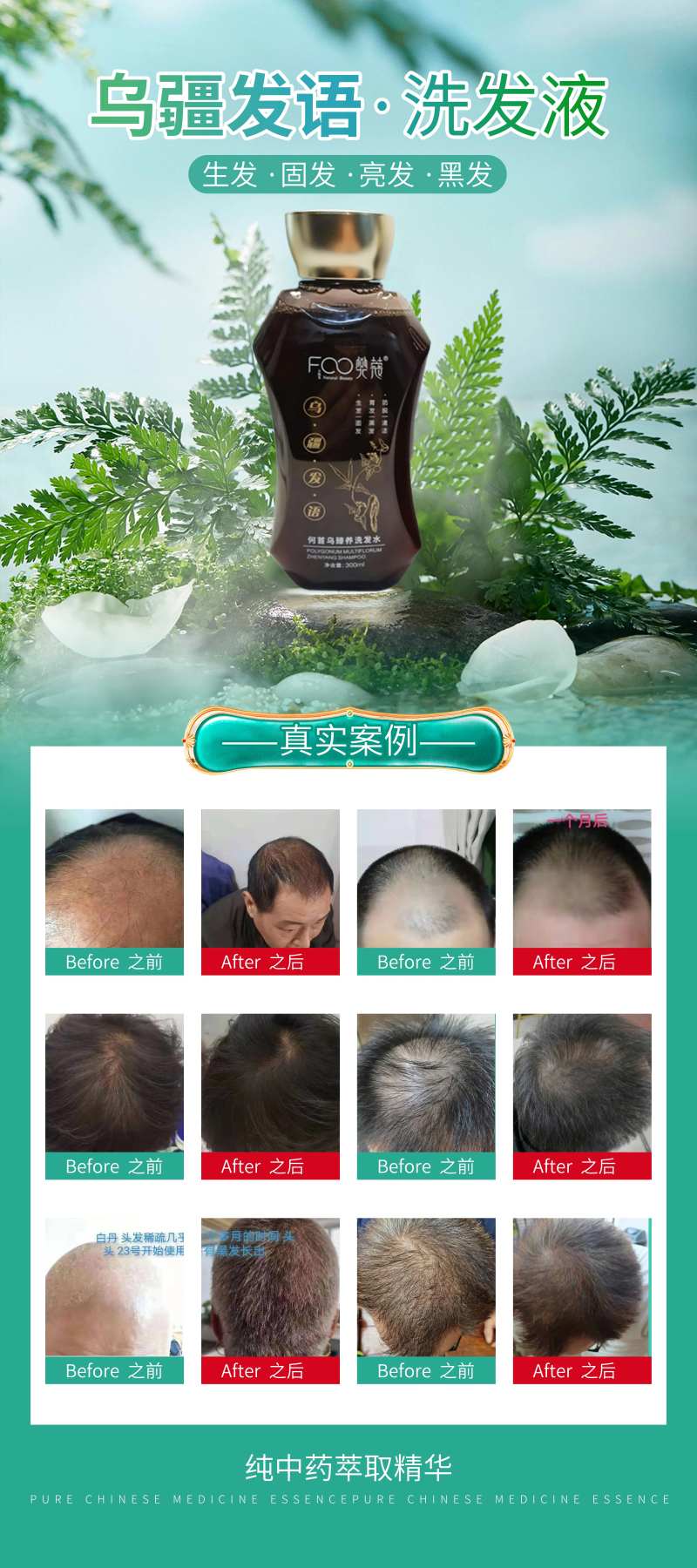 生发液案例海报-采灵感-cailinggan.com