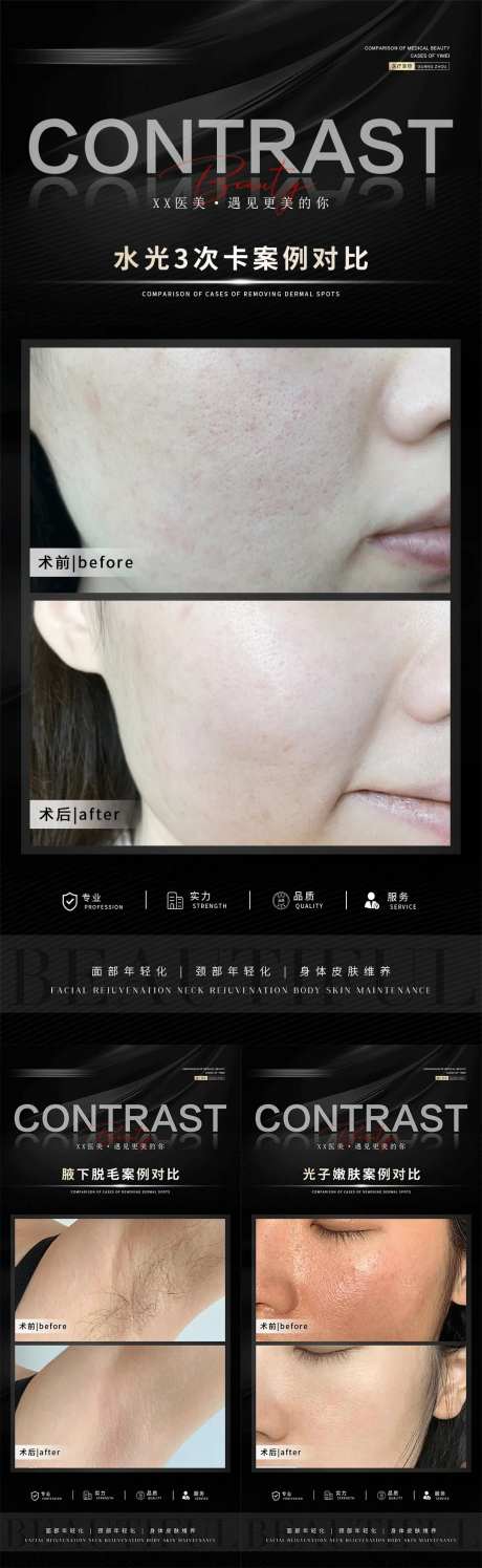 整形真人案例分享集-采灵感-https://www.cailinggan.com/