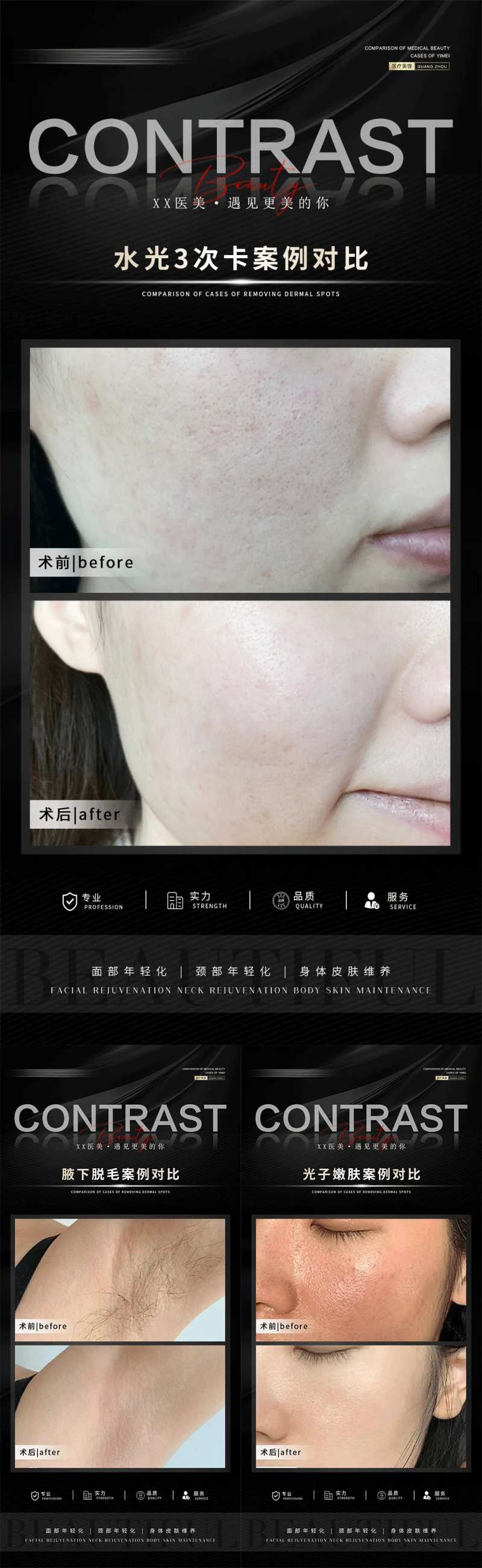 整形真人案例分享集-采灵感-cailinggan.com