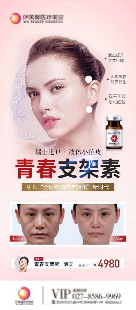 青春支架素医美海报-采灵感-https://www.cailinggan.com/