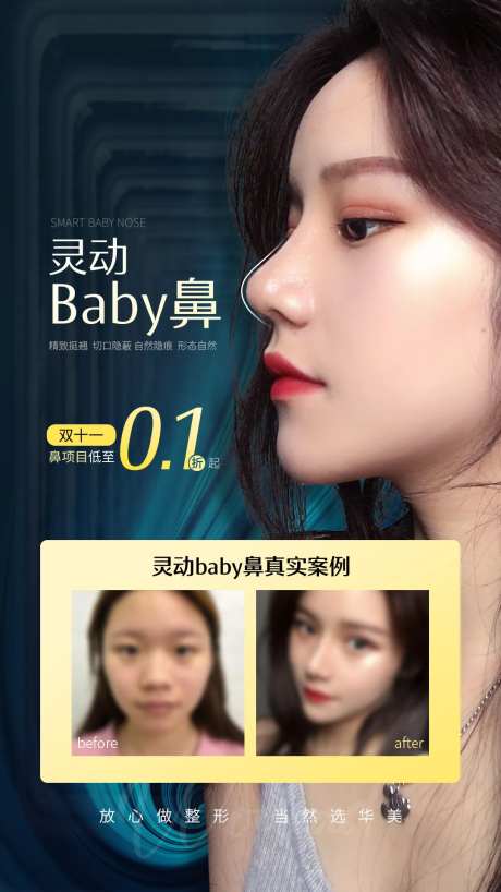 医美鼻部整形案例海报-采灵感-https://www.cailinggan.com/