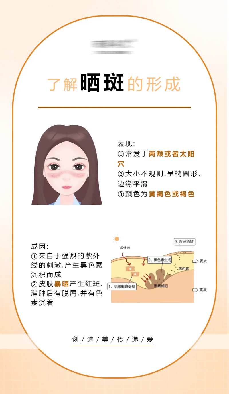 了解晒斑的形成简约海报-采灵感-cailinggan.com