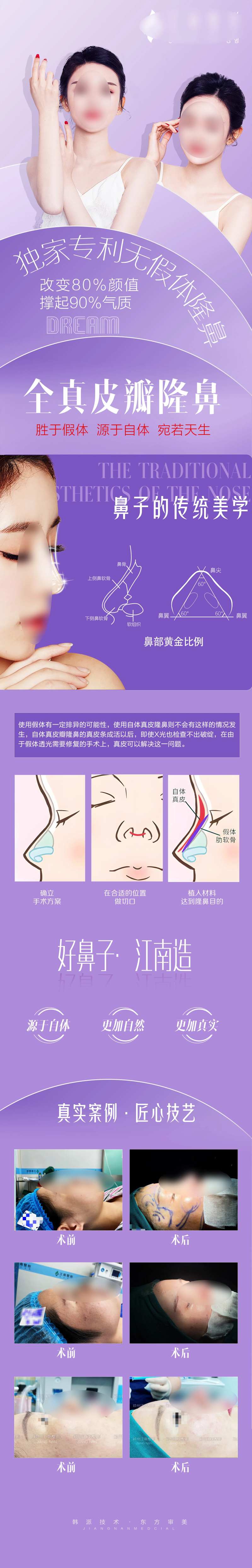 医美隆鼻鼻综合长图-采灵感-cailinggan.com