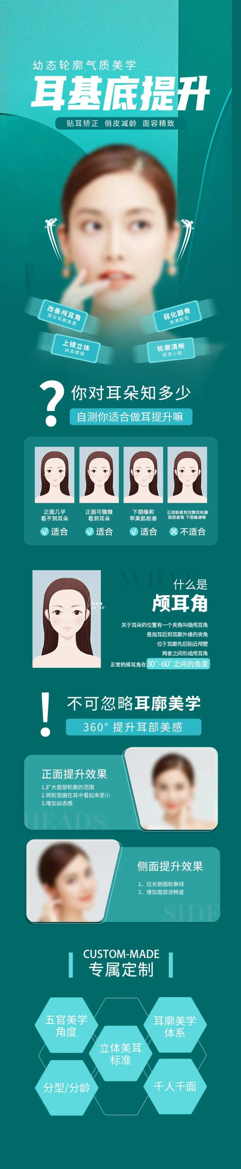 耳基底提升 -采灵感-cailinggan.com