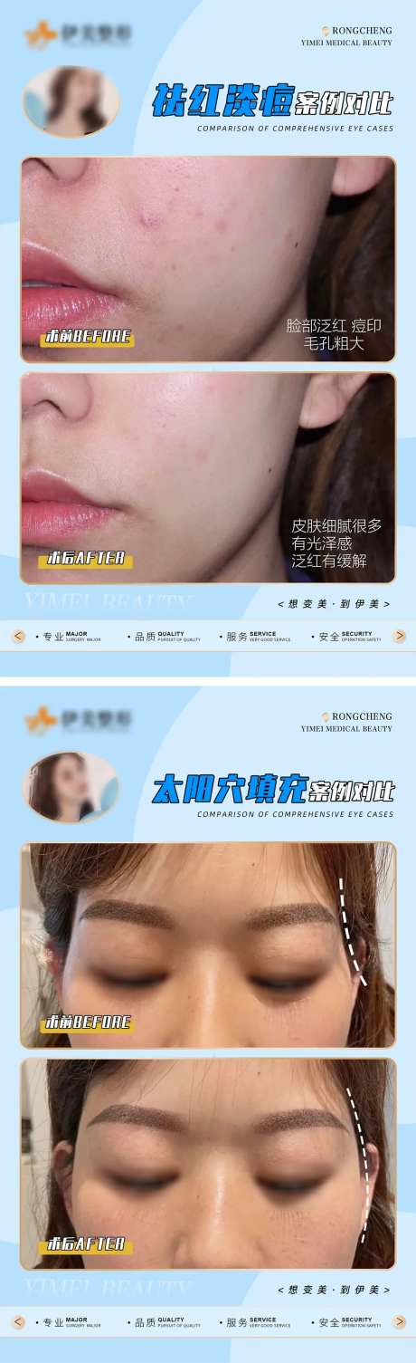 医美案例对比模版海报-采灵感-https://www.cailinggan.com/