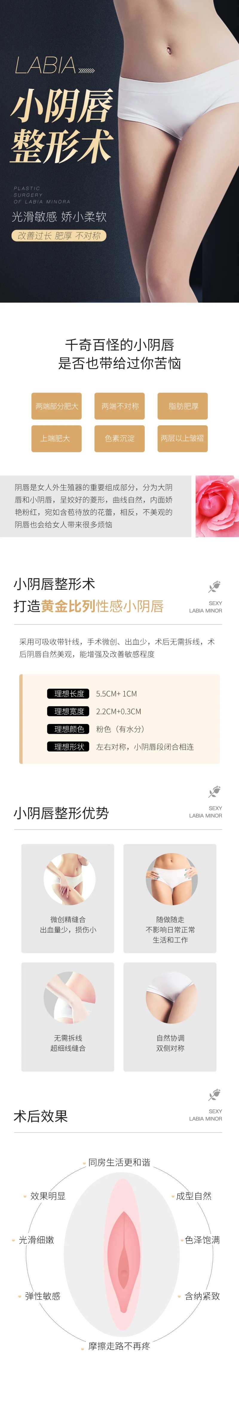 小阴唇整形-采灵感-cailinggan.com