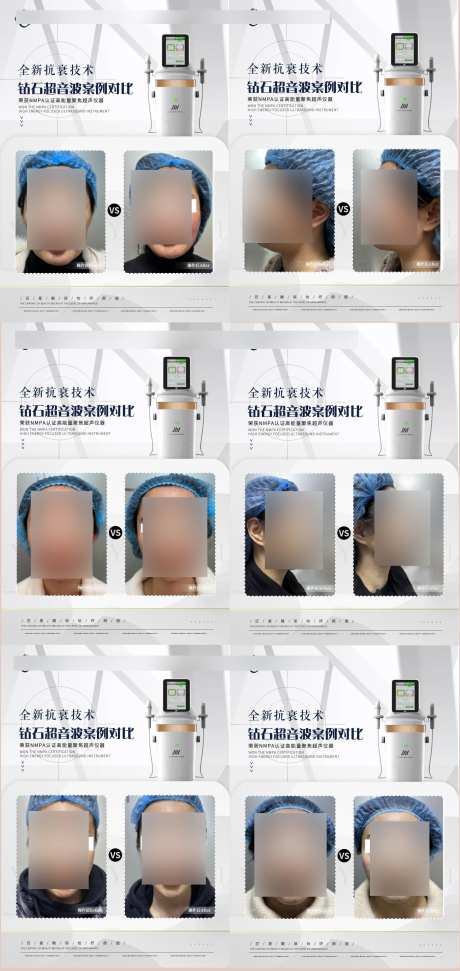 钻石超音波仪器案例对比海报-采灵感-https://www.cailinggan.com/