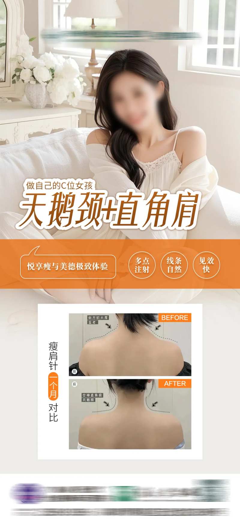 瘦肩针对比案列图简约海报-采灵感-cailinggan.com