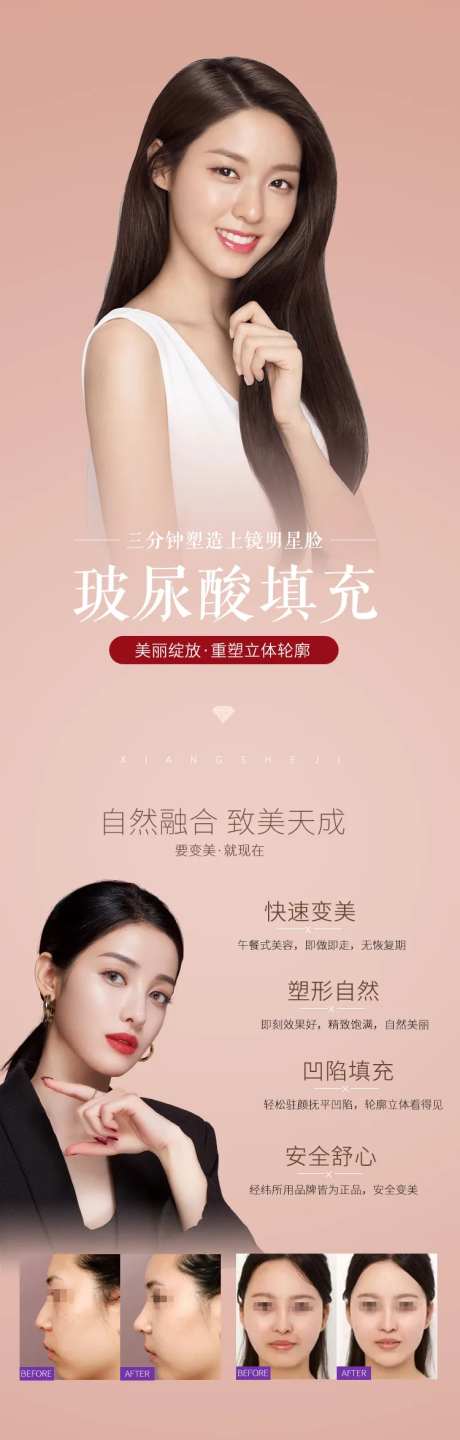 医美整形美容玻尿酸填充长图-采灵感-https://www.cailinggan.com/