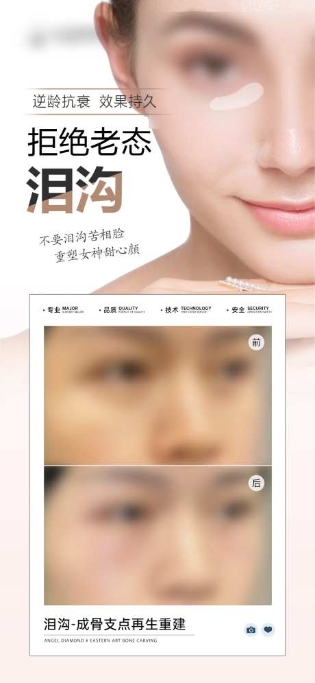 医美泪沟整形案例宣传海报-采灵感-https://www.cailinggan.com/