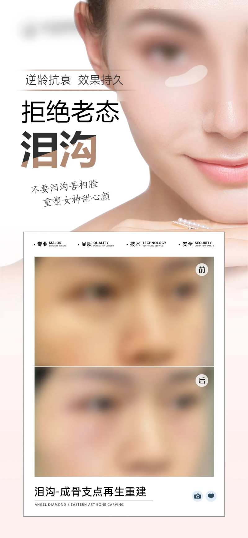医美泪沟整形案例宣传海报-采灵感-cailinggan.com