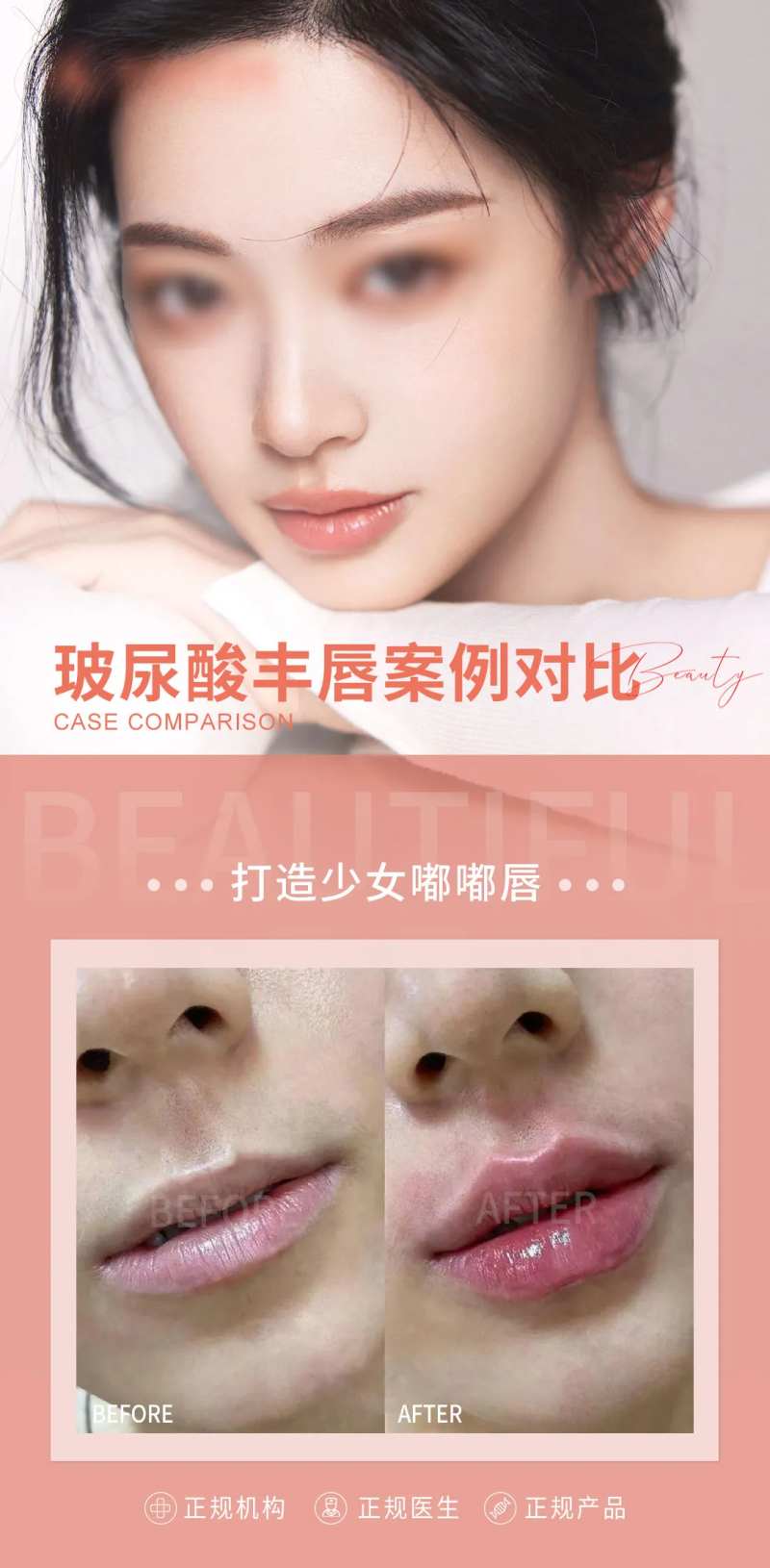 医美丰唇海报-采灵感-cailinggan.com