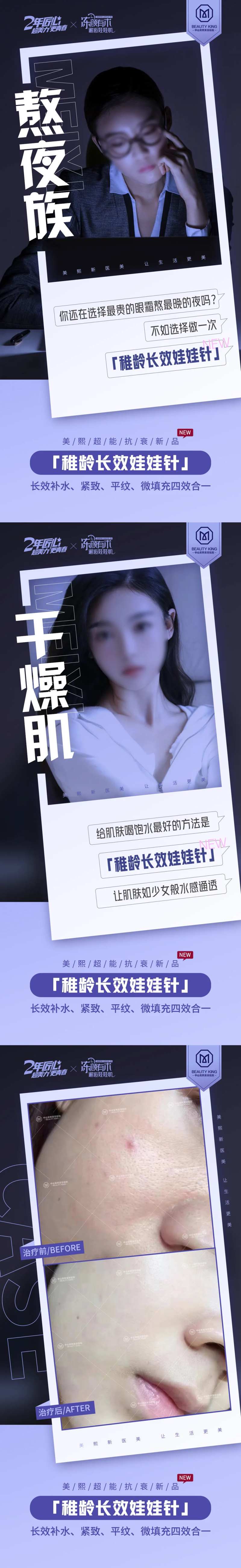 娃娃针功效系列海报-采灵感-cailinggan.com