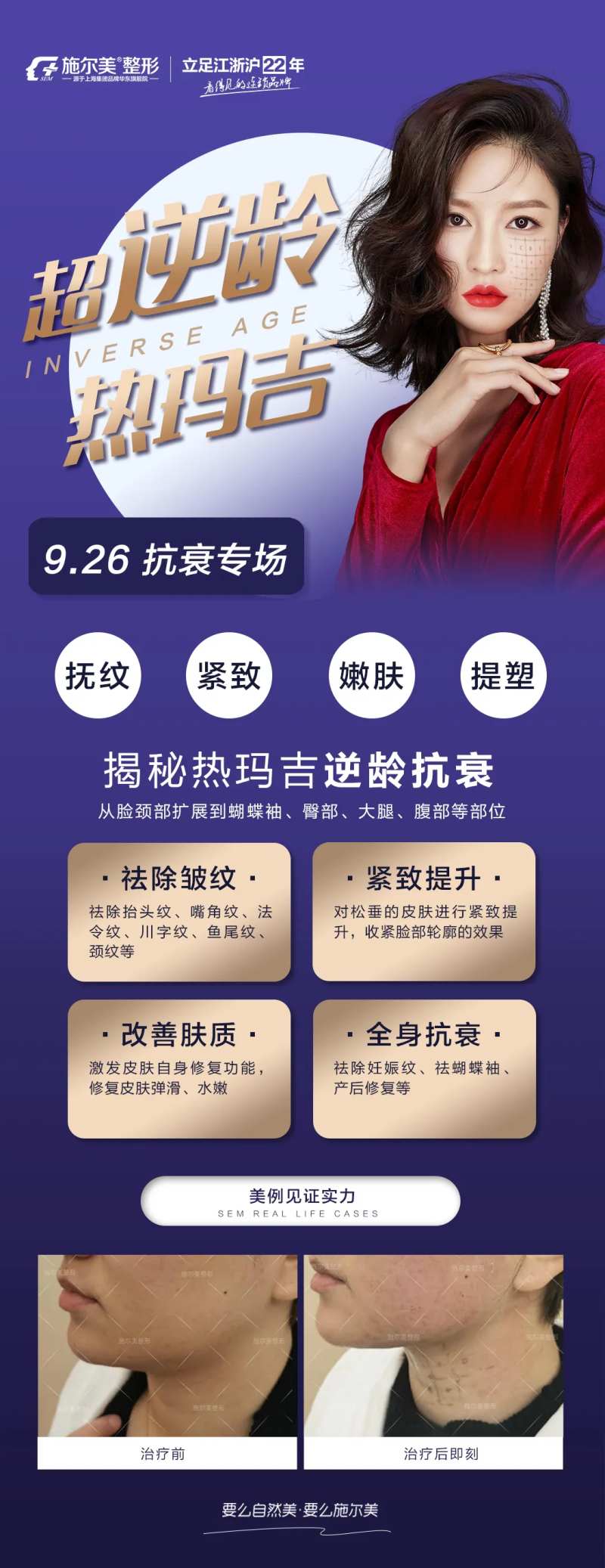 医美热玛吉海报-采灵感-cailinggan.com