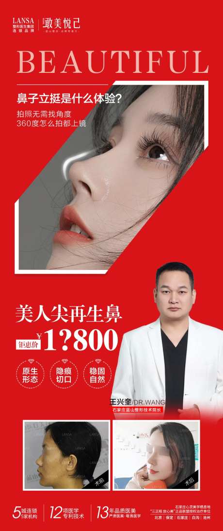 美人尖再生鼻钜惠展架-采灵感-https://www.cailinggan.com/