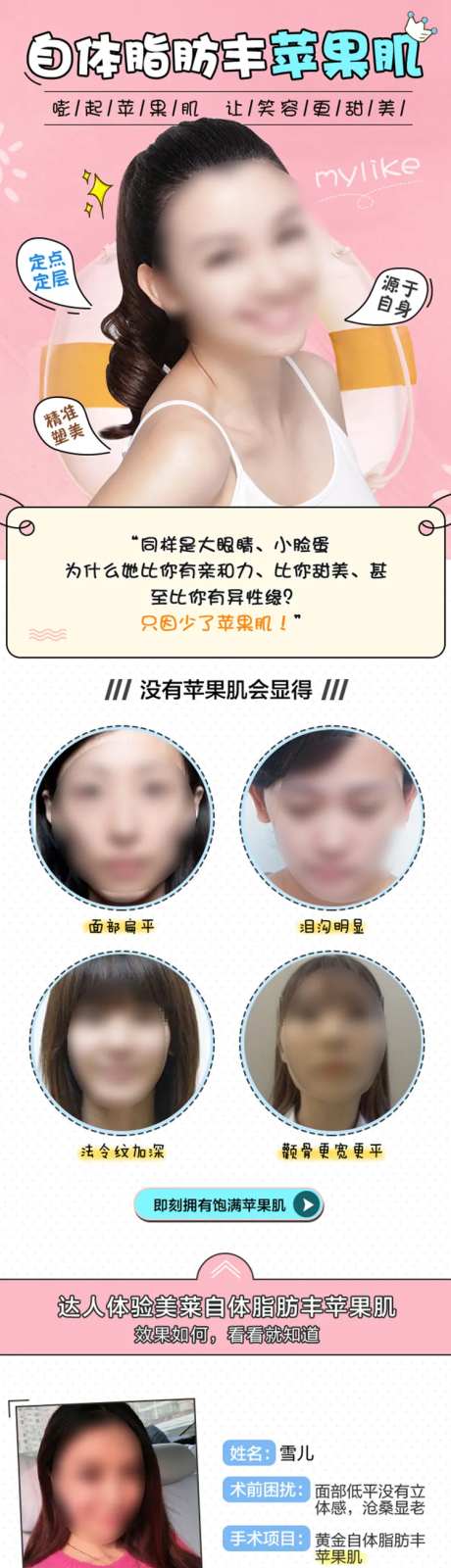 医美自体脂肪丰苹果肌详情页-采灵感-https://www.cailinggan.com/