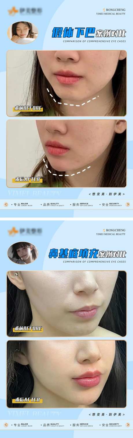 医美案例对比模版海报-采灵感-https://www.cailinggan.com/
