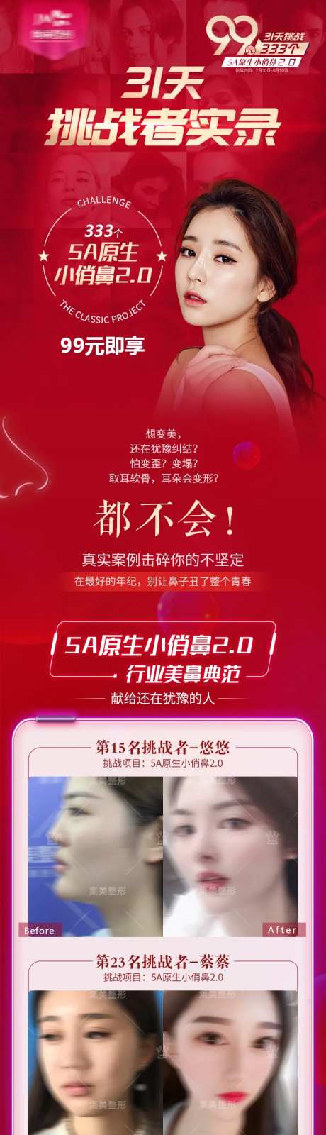 医美隆鼻案例长图-采灵感-https://www.cailinggan.com/