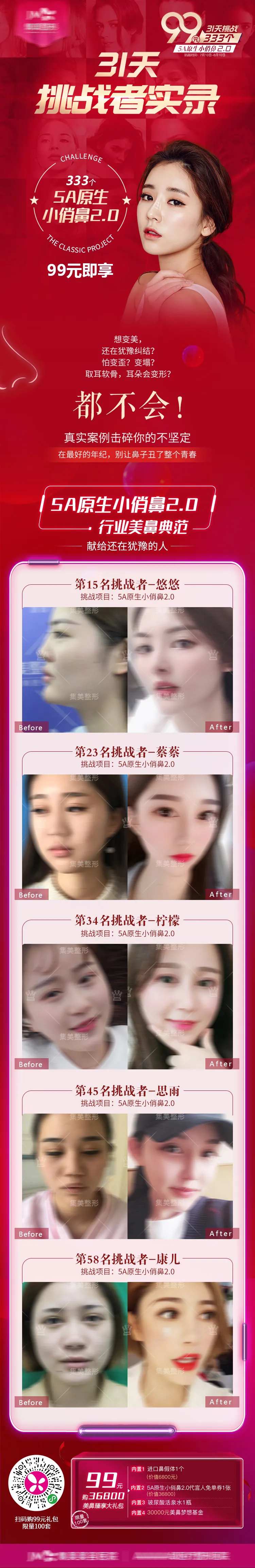 医美隆鼻案例长图-采灵感-cailinggan.com