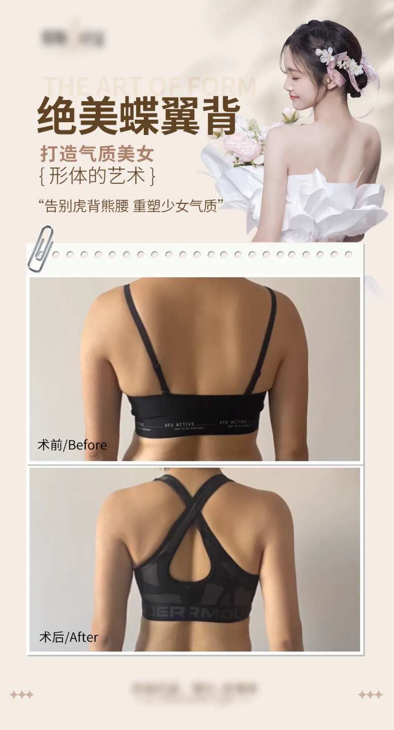 医美少女背海报-采灵感-cailinggan.com