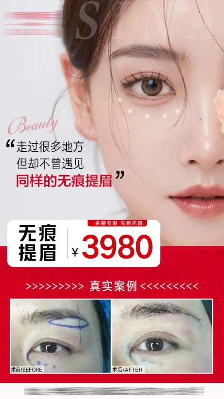 医美无痕提眉海报-采灵感-https://www.cailinggan.com/