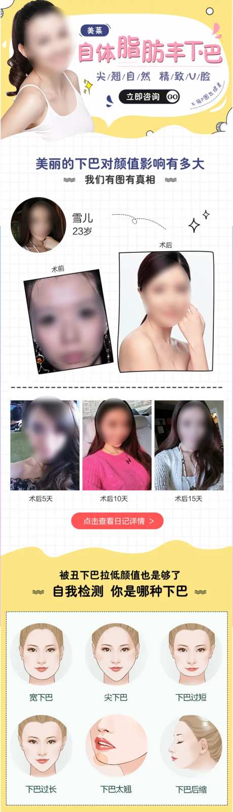 医美自体脂肪丰下巴详情页-采灵感-https://www.cailinggan.com/