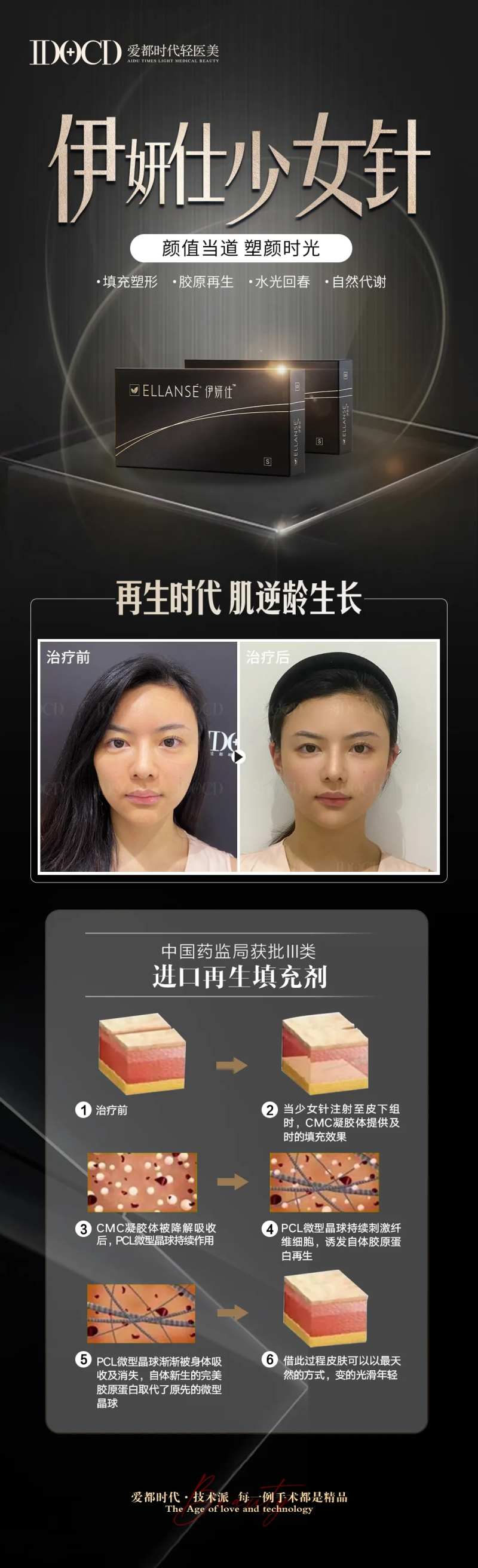 医美伊妍仕少女针案例长图海报-采灵感-cailinggan.com