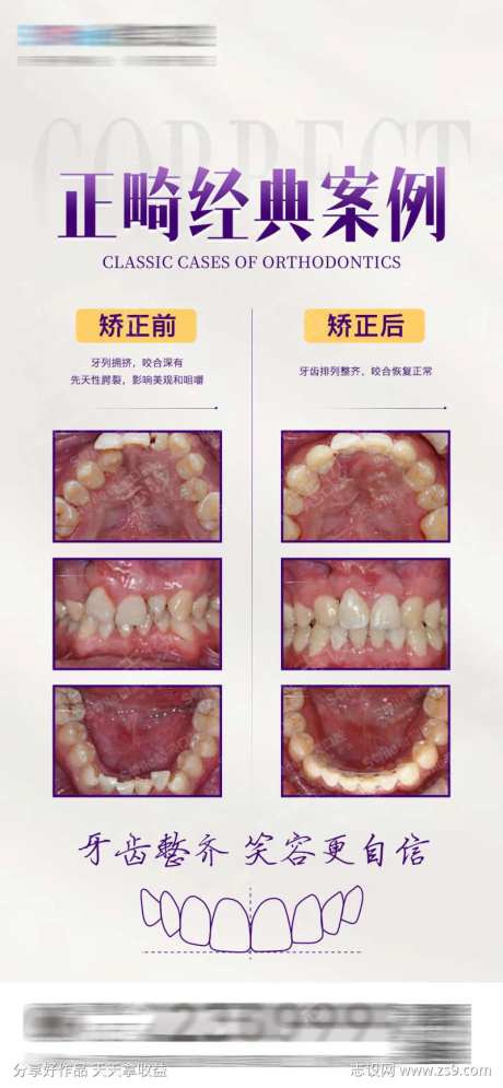 医美口腔正畸案例对比海报-采灵感-https://www.cailinggan.com/