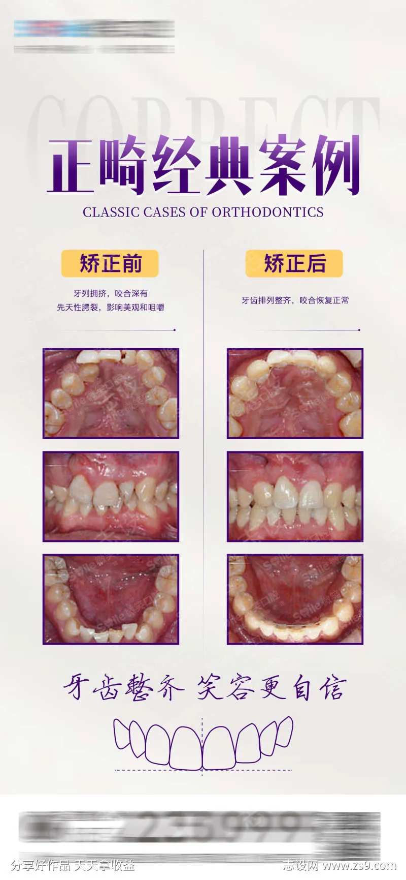 医美口腔正畸案例对比海报-采灵感-cailinggan.com