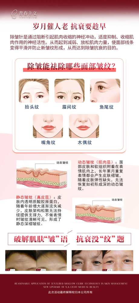 除皱的好处-采灵感-https://www.cailinggan.com/