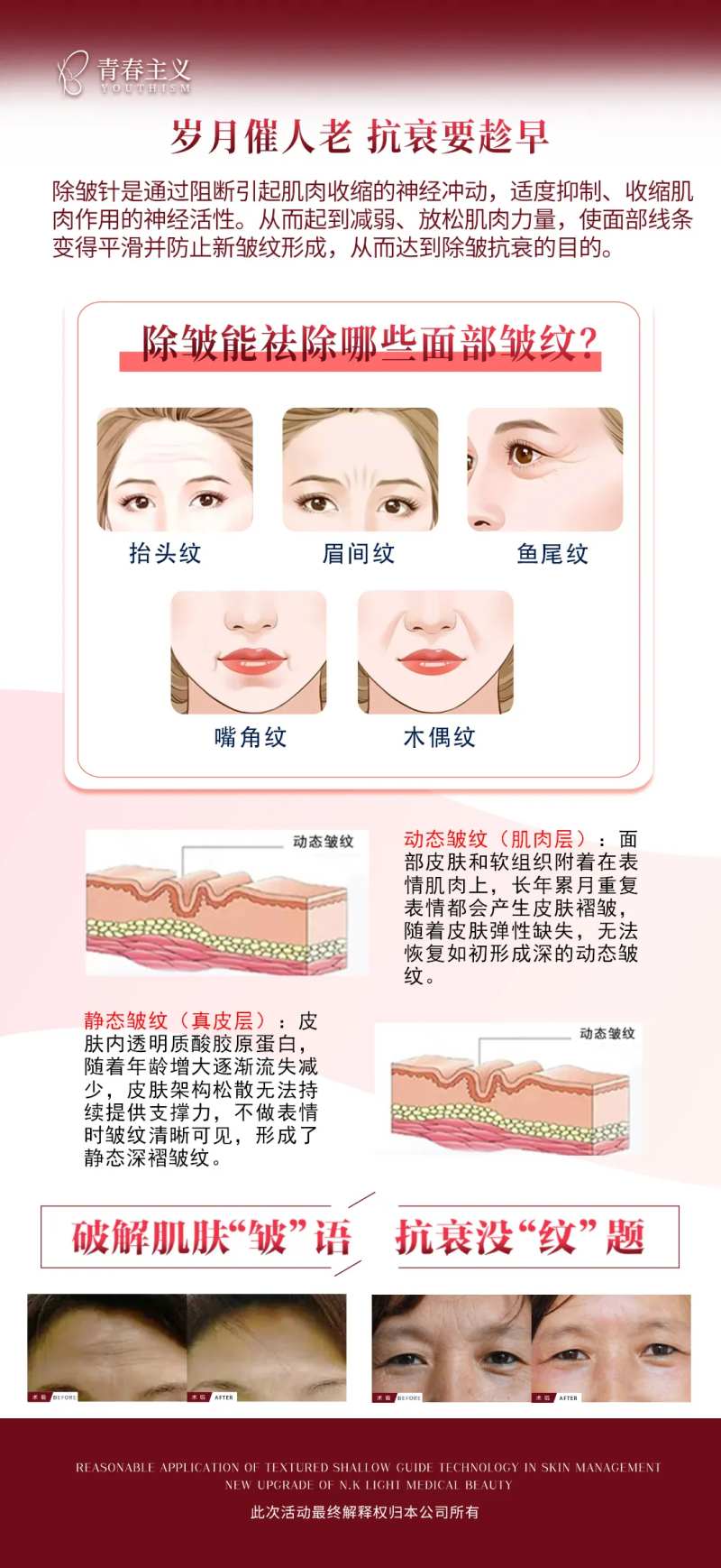 除皱的好处-采灵感-cailinggan.com