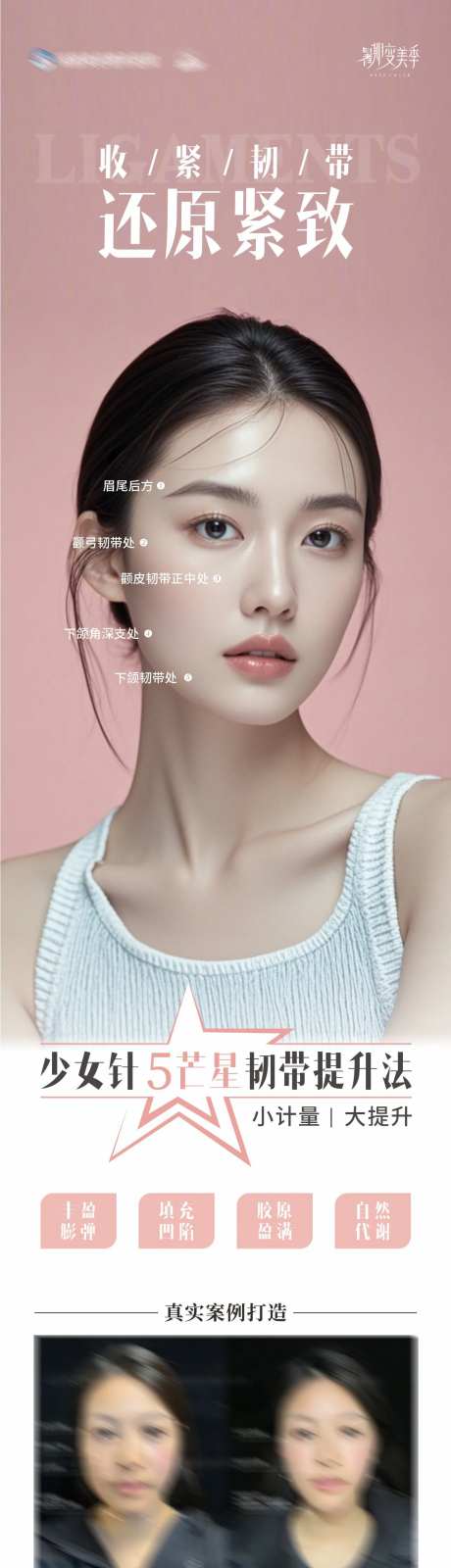 还原紧致医美海报-采灵感-https://www.cailinggan.com/