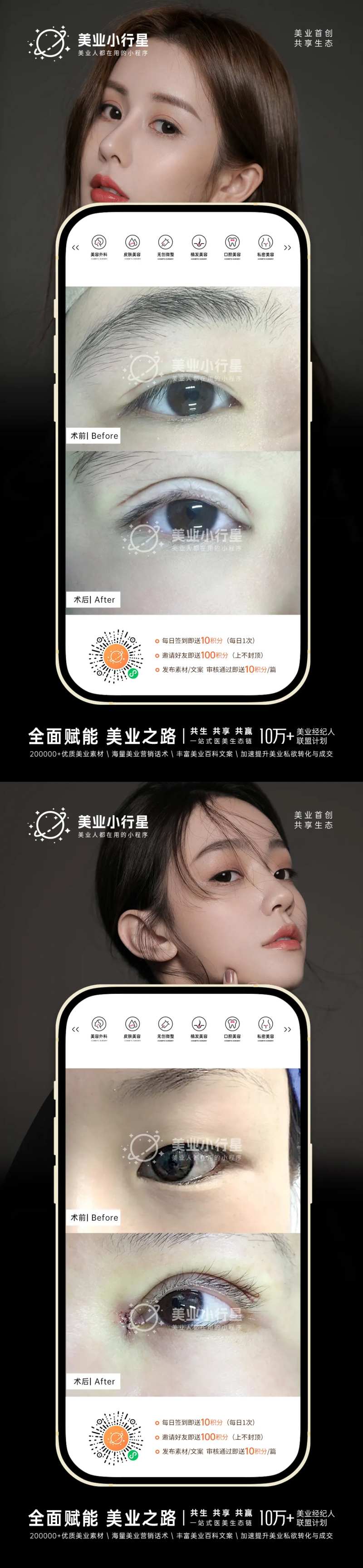 医美整形美容真人案例分享集-采灵感-cailinggan.com
