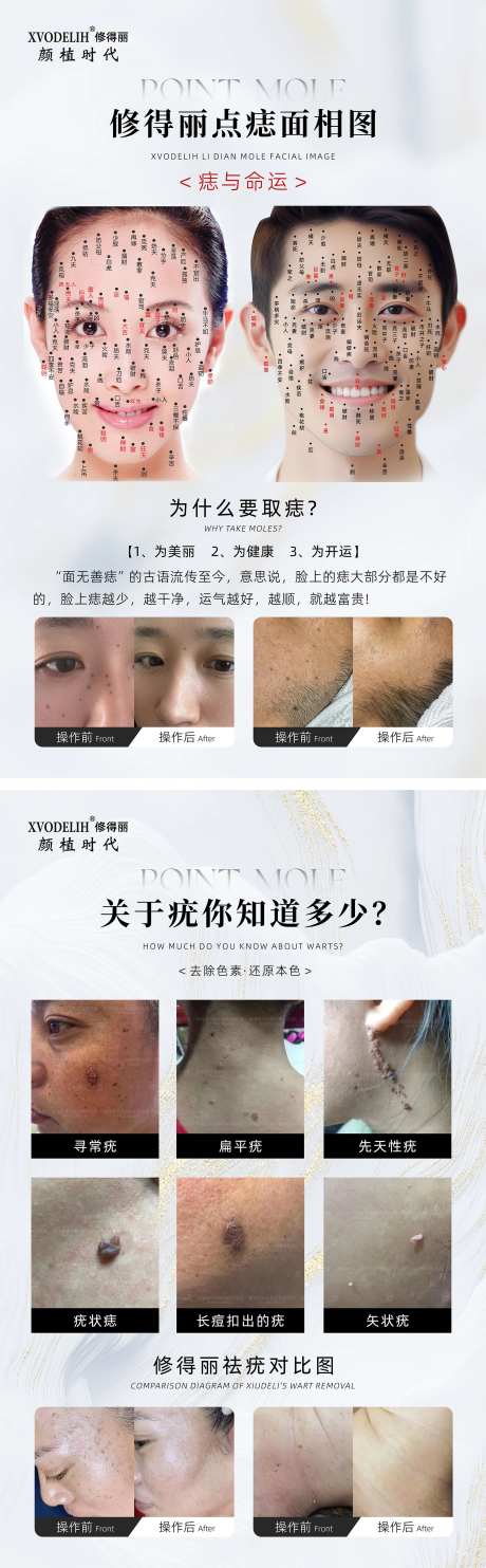 医美美容点痣面相图祛疣介绍海报-采灵感-https://www.cailinggan.com/