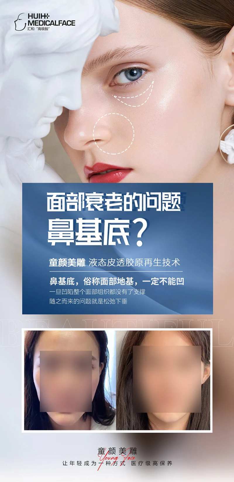 医美面部衰老简约海报-采灵感-cailinggan.com