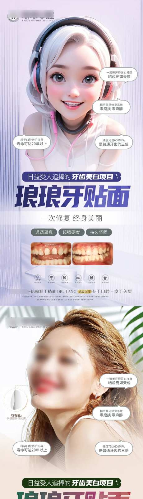 瓷贴面系列海报-采灵感-https://www.cailinggan.com/
