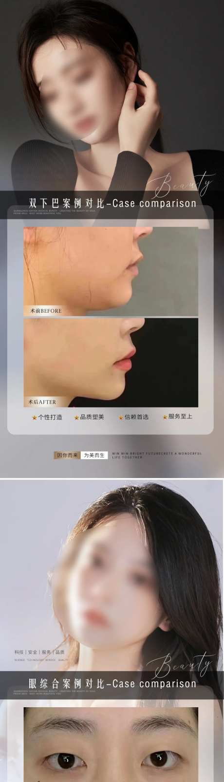 医美整形案例对比海报-采灵感-https://www.cailinggan.com/