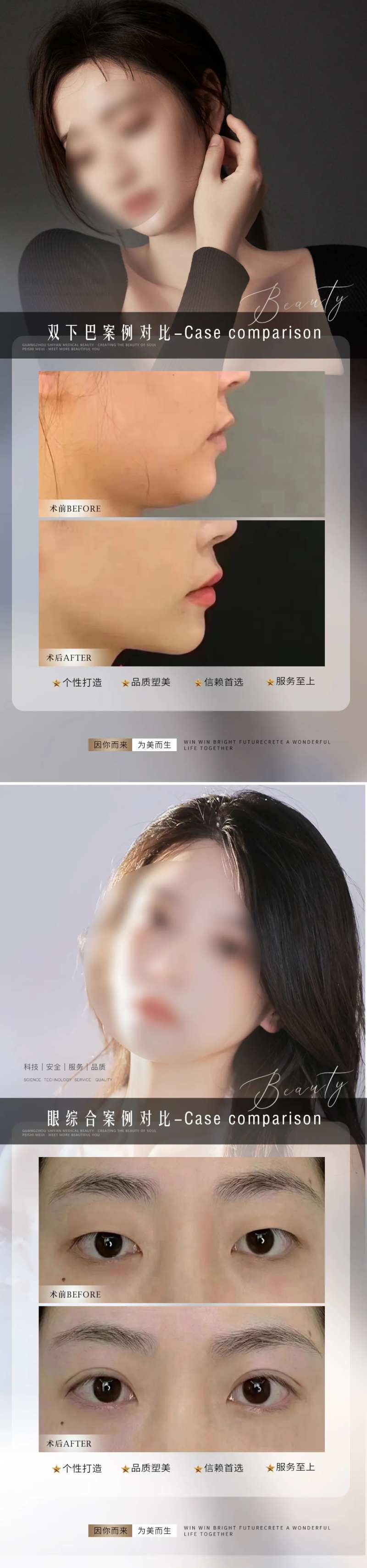 医美整形案例对比海报-采灵感-cailinggan.com