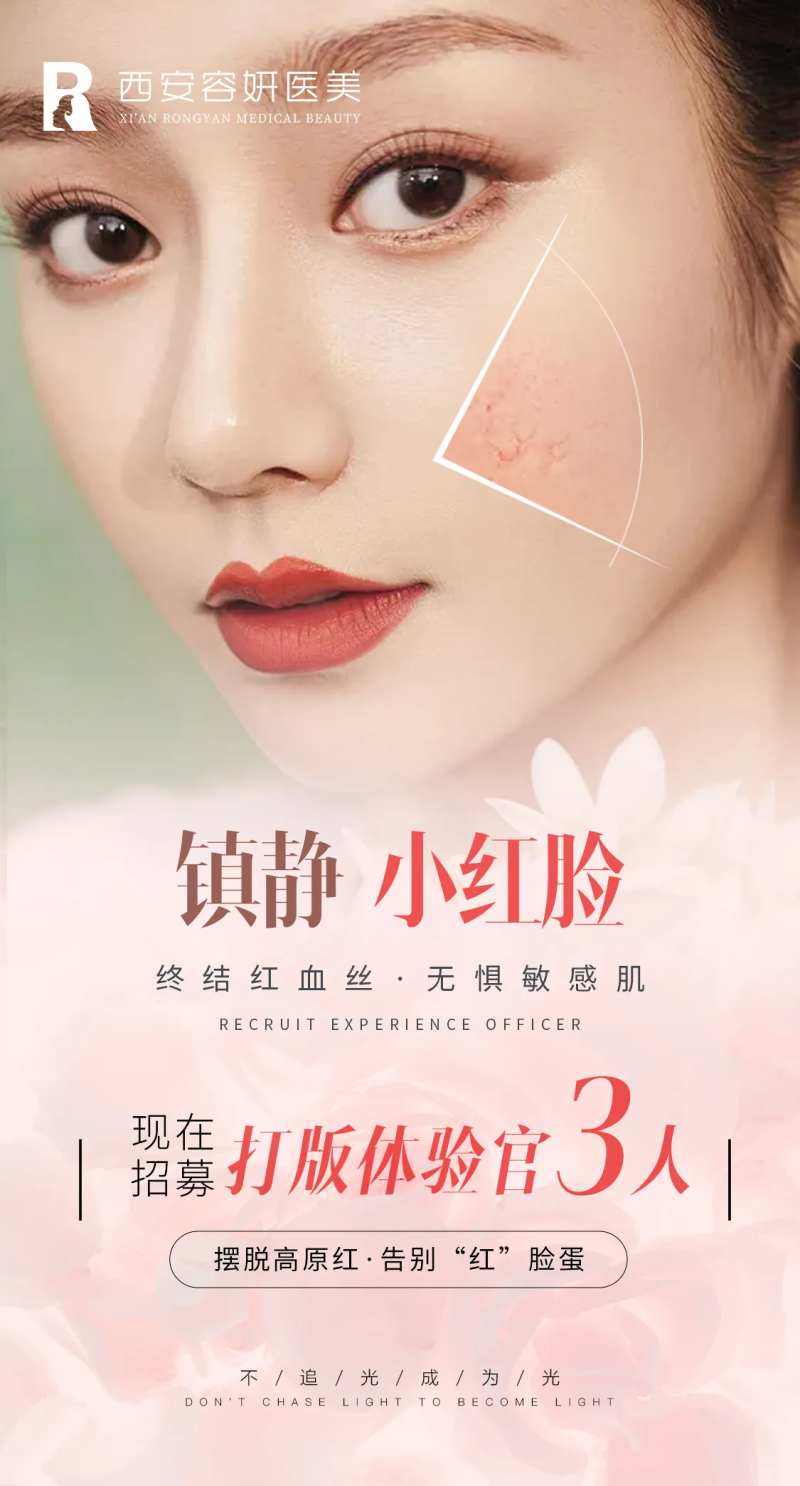 祛红血丝体验官招募-采灵感-cailinggan.com