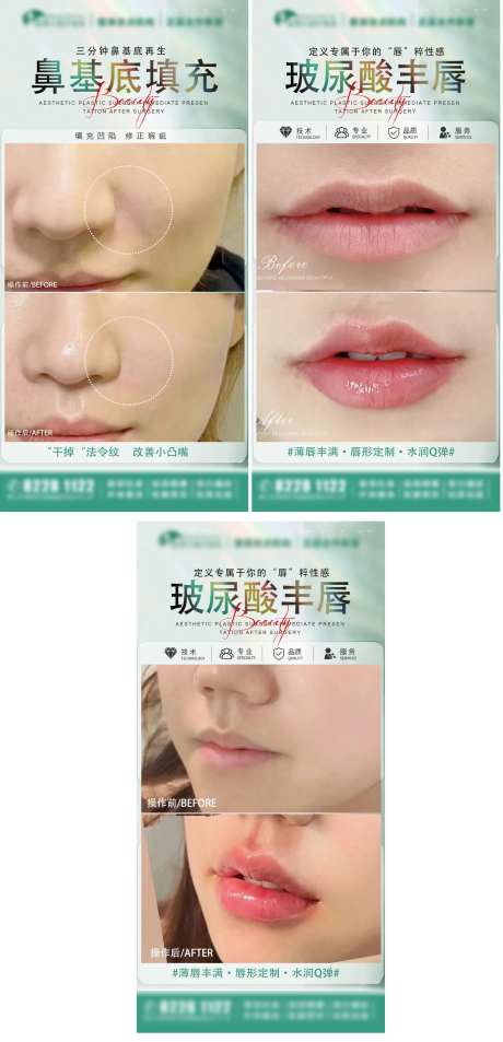 医美玻尿酸丰唇海报-采灵感-https://www.cailinggan.com/