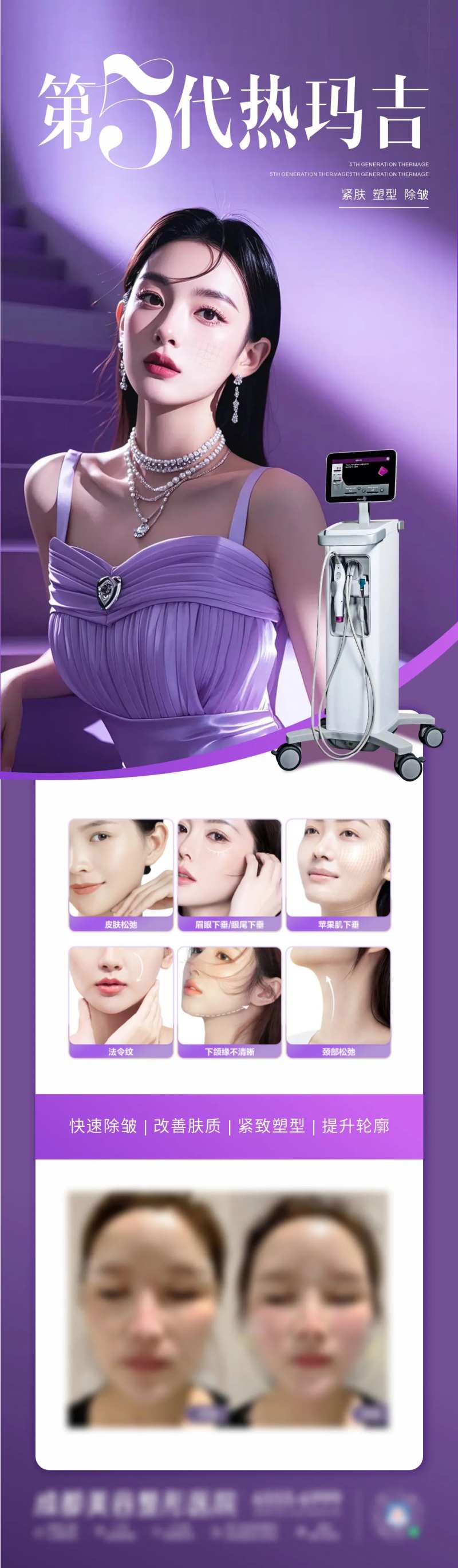 医美热玛吉仪器长图-采灵感-cailinggan.com