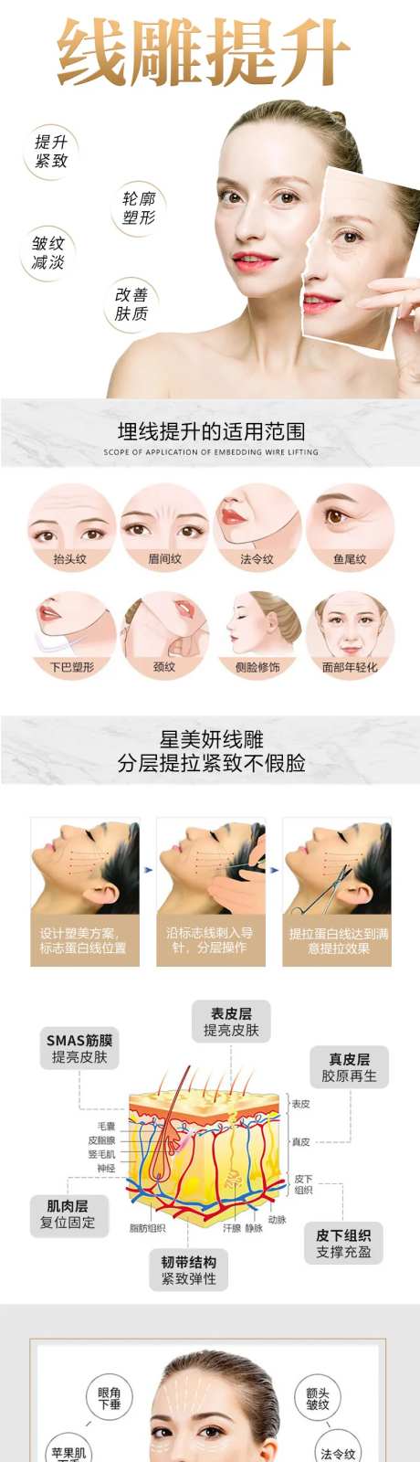线雕提升-采灵感-https://www.cailinggan.com/