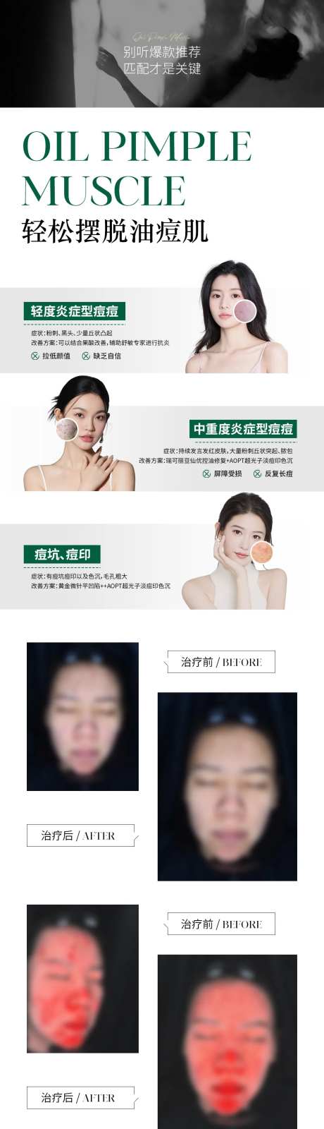 轻松摆脱油痘肌海报-采灵感-https://www.cailinggan.com/