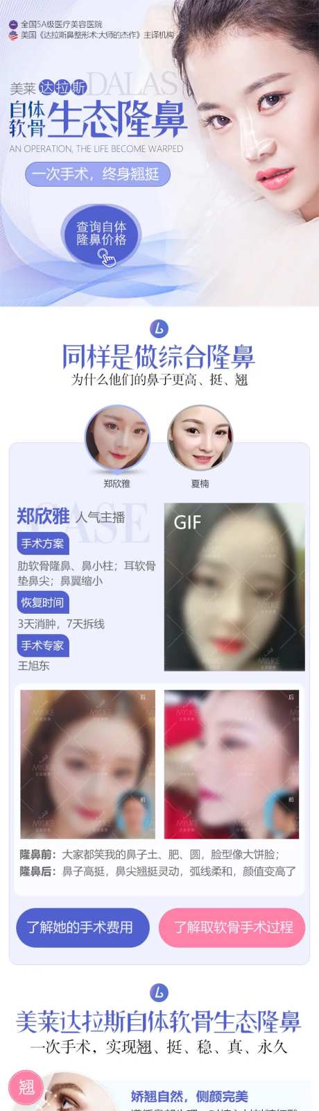 自体软骨隆鼻-采灵感-https://www.cailinggan.com/