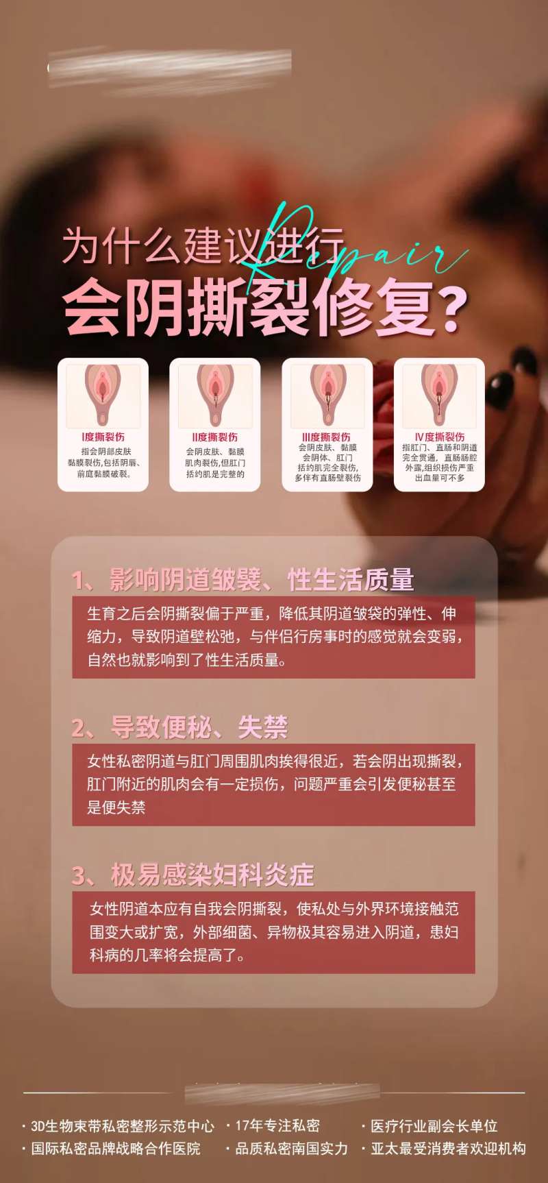 会阴撕裂修复-采灵感-cailinggan.com